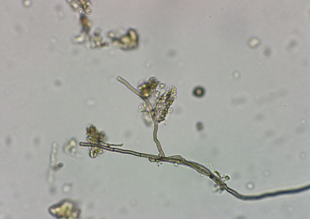 Up close and personal with the saprophytic fungi that is a feature of good compost.